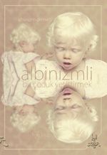 Albinizmli Bir Çocuk Yetiştirmek