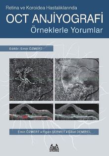 Retina ve Koroidea Hastalıklarında OCT Anjiyografi & Örneklerle Yorumlar