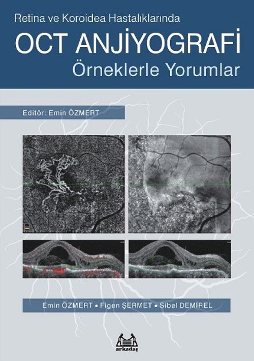 Retina ve Koroidea Hastalıklarında OCT Anjiyografi & Örneklerle Yorumlar