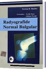 Radyografide Normal Bulgular