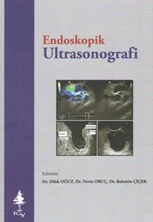 Endoskopik Ultrasonografi