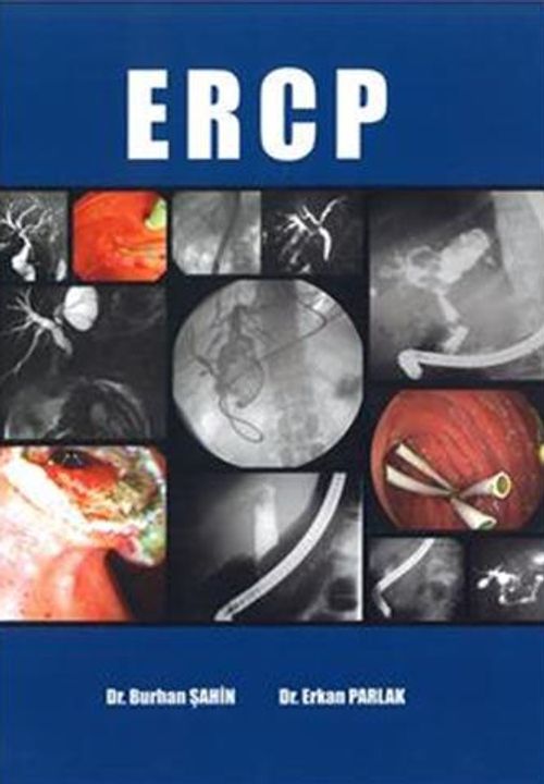 ERCP