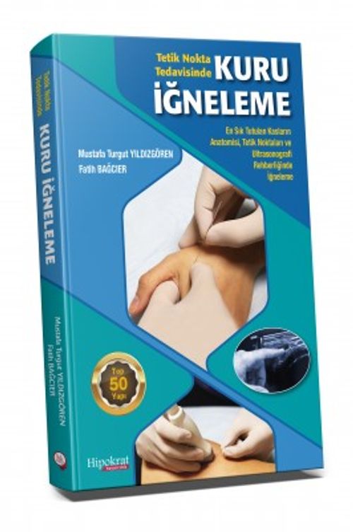 Tetik Nokta Tedavisinde Kuru İğneleme