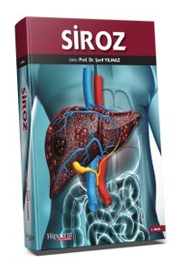 Siroz