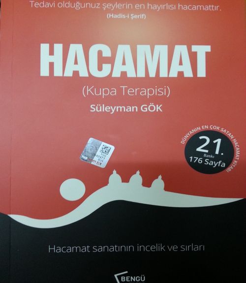 Hacamat (Kupa Terapisi)