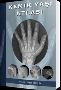 Kemik Yaşı Atlası