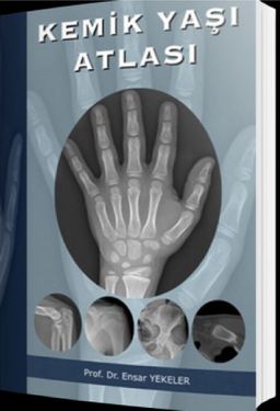 Kemik Yaşı Atlası