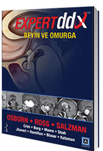 Expert DDX: Beyin ve Omurga