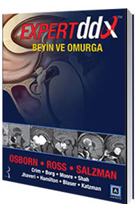 Expert DDX: Beyin ve Omurga
