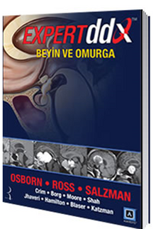 Expert DDX: Beyin ve Omurga