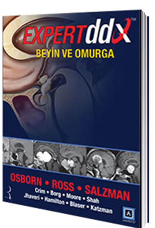 Expert DDX: Beyin ve Omurga