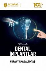 50 Soruda Dental İmplantlar