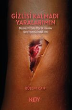 Gizlisi Kalmadı Yaralarımın