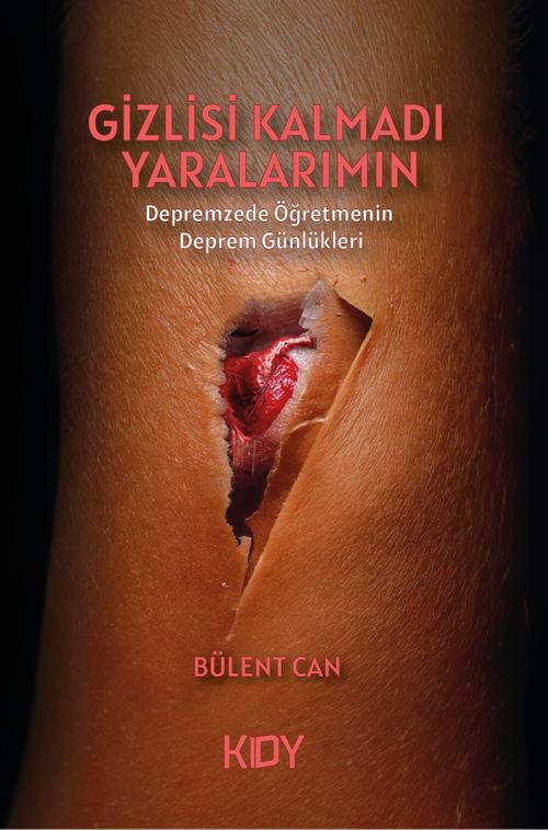 Gizlisi Kalmadı Yaralarımın