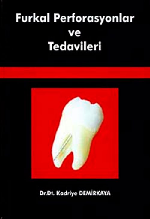 Furkal Perforasyonlar ve Tedavileri