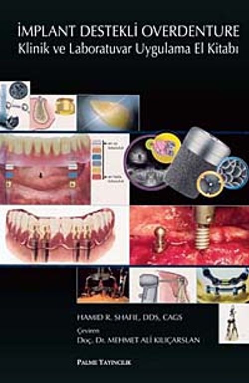 İmplant Destekli Overdenture & Klinik ve Laboratuvar Uygulama El Kitabı