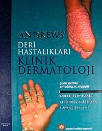 Andrew's Deri Hastalıkları Klinik Dermatoloji
