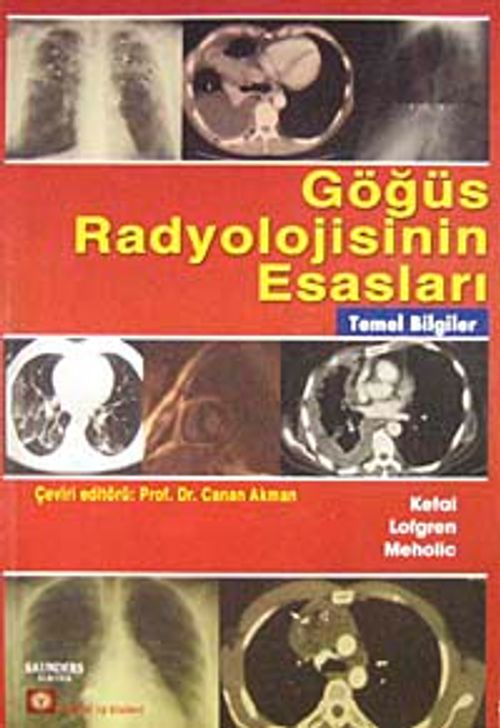 Göğüs Radyolojisinin Esasları & Temel Bilgiler