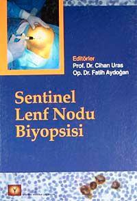 Sentinel Lenf Nodu Biyopsisi