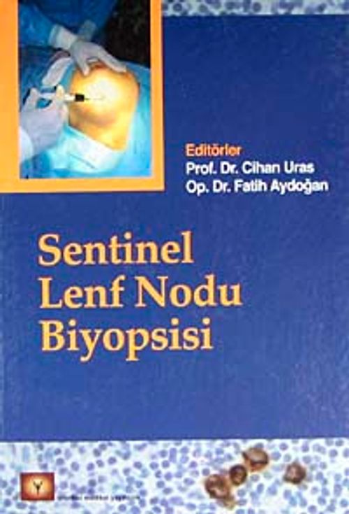 Sentinel Lenf Nodu Biyopsisi
