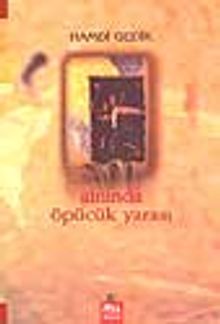 Alnında Öpücük Yarası