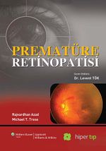 Prematüre Retinopatisi