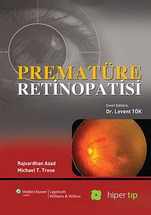 Prematüre Retinopatisi