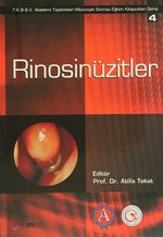 Rinosinüzitler