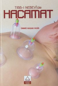 Tıbb-ı Nebevi'de Hacamat