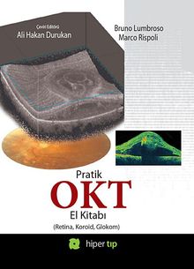 Pratik OKT El Kitabı (Retina, Koroid, Glokom)