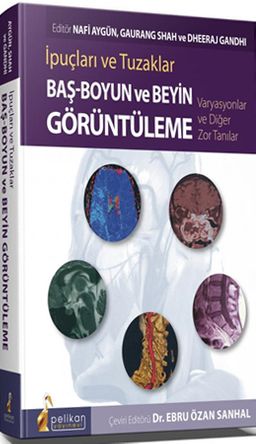 İpuçları ve Tuzaklar Baş - Boyun ve Beyin Görüntüleme Varyasyonlar ve Diğer Zor Tanılar