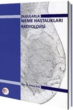 Olgularla Meme Hastalıkları Radyolojisi