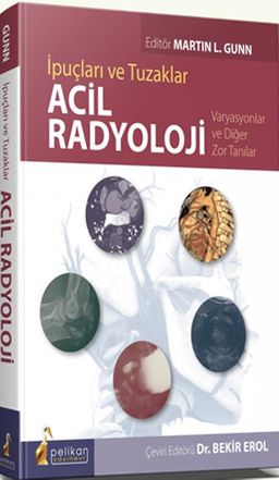 İpuçları ve Tuzaklar Acil Radyoloji Varyasyonlar ve Diğer Zor Tanılar