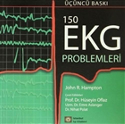 150 EKG Problemleri