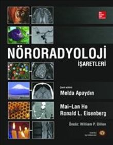 Nöroradyoloji İşaretleri