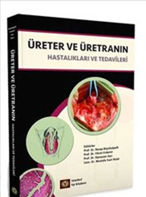 Üreter ve Üretranın Hastalıkları ve Tedavileri