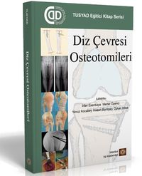 Diz Çevresi Osteotomileri