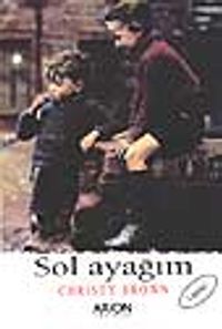 Sol Ayağım